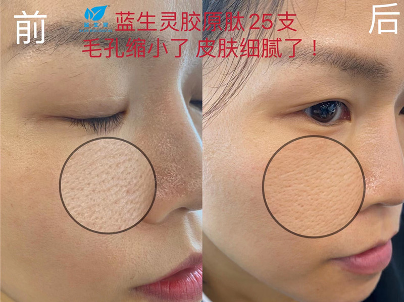 重磅新品丨一月?lián)Q膚！她們是吃了美顏相機(jī)吧？？