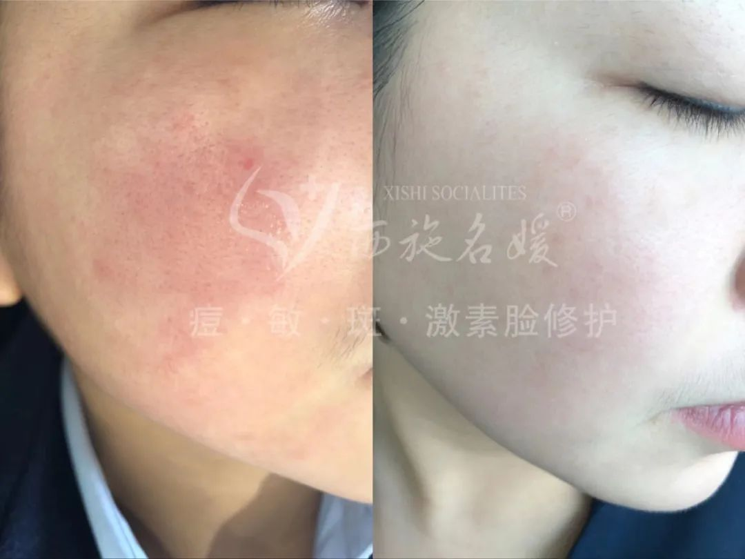 三八節(jié)丨女神請(qǐng)變美~