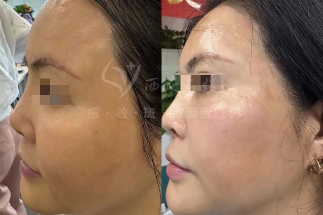 新品速遞丨拓客王者，升級(jí)回歸
