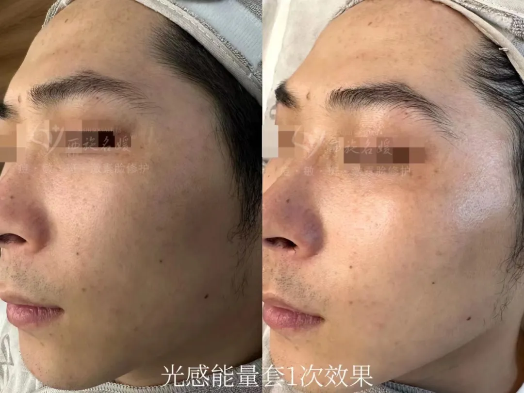 新品速遞丨拓客王者，升級(jí)回歸